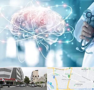 دکتر سکته مغزی در بلوار فردوس 