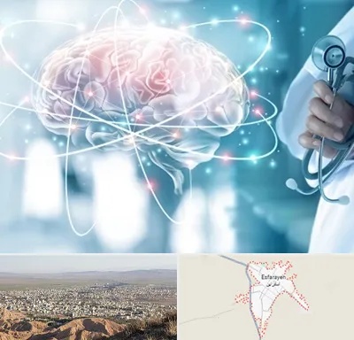 دکتر سکته مغزی در اسفراین