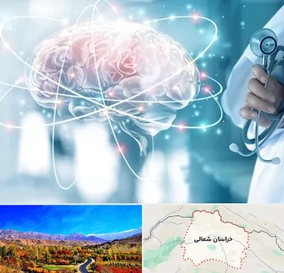 دکتر سکته مغزی در خراسان شمالی
