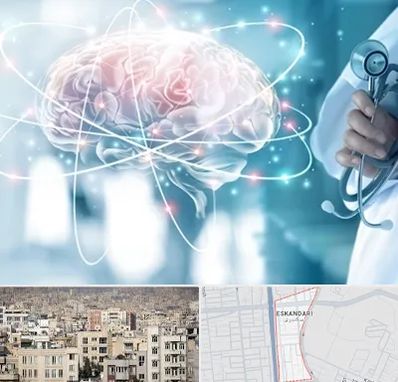 دکتر سکته مغزی در اسکندری