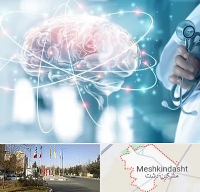 دکتر سکته مغزی در مشکین دشت