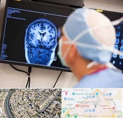 دکتر مغز و اعصاب کودکان در شهرک غرب مشهد 