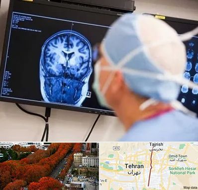 دکتر مغز و اعصاب کودکان در ولیعصر 