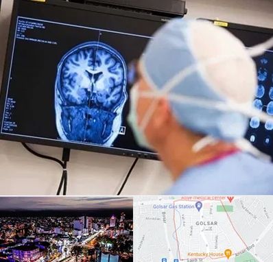 دکتر مغز و اعصاب کودکان در گلسار رشت 