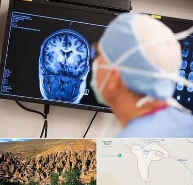 دکتر مغز و اعصاب کودکان در اسکو