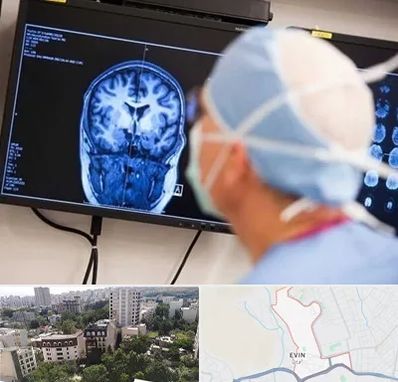 دکتر مغز و اعصاب کودکان در اوین