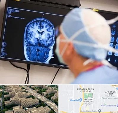 دکتر مغز و اعصاب کودکان در اکباتان 