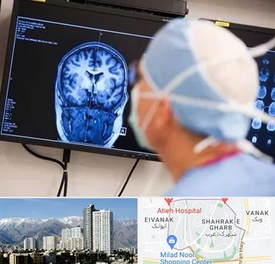 دکتر مغز و اعصاب کودکان در شهرک غرب 