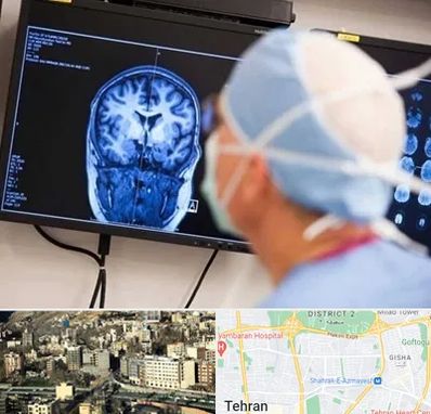 دکتر مغز و اعصاب کودکان در مرزداران 