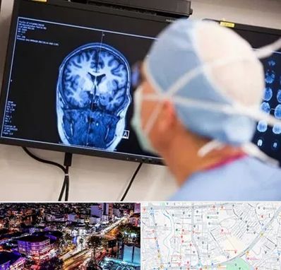 دکتر مغز و اعصاب کودکان در منظریه رشت 