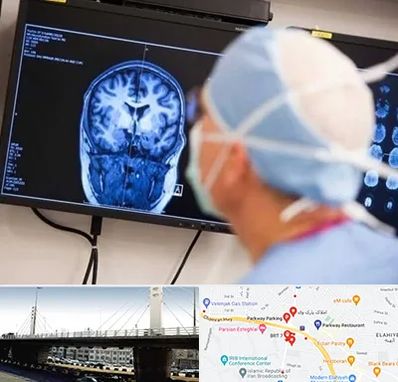 دکتر مغز و اعصاب کودکان در پارک وی 