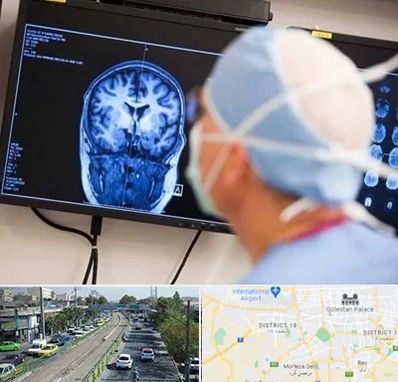 دکتر مغز و اعصاب کودکان در جنوب تهران 