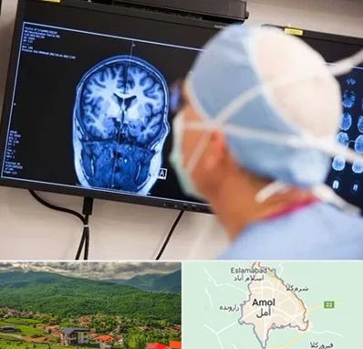 دکتر مغز و اعصاب کودکان در آمل