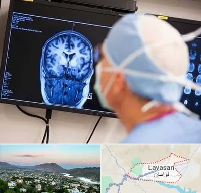 دکتر مغز و اعصاب کودکان در لواسان