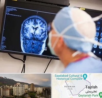 دکتر مغز و اعصاب کودکان در زعفرانیه 