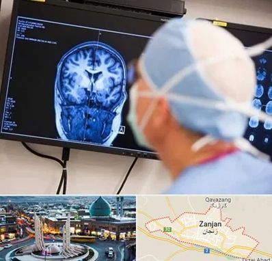 دکتر مغز و اعصاب کودکان در زنجان