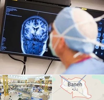 دکتر مغز و اعصاب کودکان در بانه