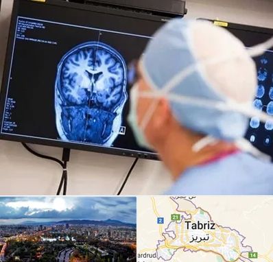 دکتر مغز و اعصاب کودکان در تبریز