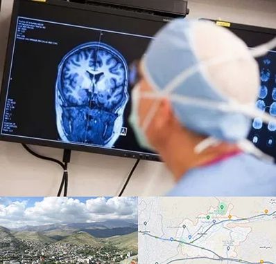 دکتر مغز و اعصاب کودکان در رودهن