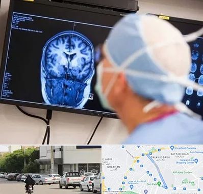 دکتر مغز و اعصاب کودکان در قدوسی شرقی شیراز 