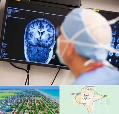 دکتر مغز و اعصاب کودکان در ساری