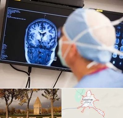 دکتر مغز و اعصاب کودکان در تویسرکان