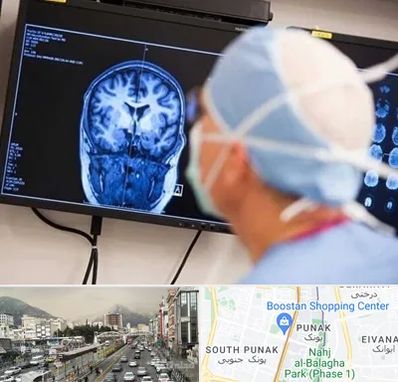 دکتر مغز و اعصاب کودکان در پونک 