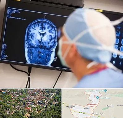 دکتر مغز و اعصاب کودکان در دماوند