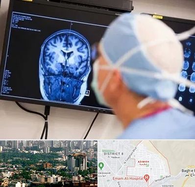 دکتر مغز و اعصاب کودکان در عظیمیه کرج 