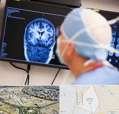 دکتر مغز و اعصاب کودکان در اندیشه