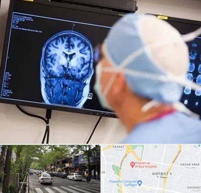 دکتر مغز و اعصاب کودکان در ظفر 