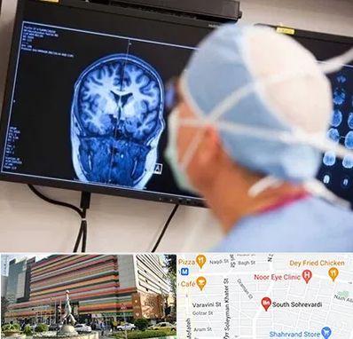 دکتر مغز و اعصاب کودکان در سهروردی 