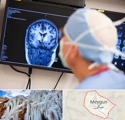 دکتر مغز و اعصاب کودکان در میگون