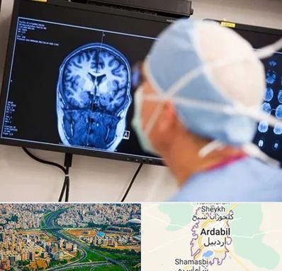 دکتر مغز و اعصاب کودکان در اردبیل