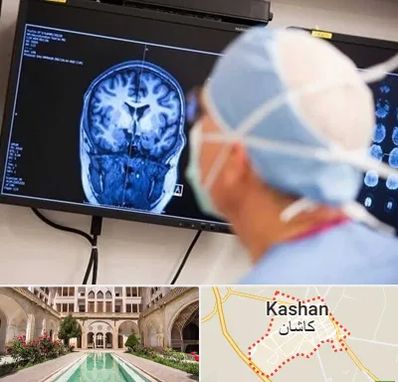 دکتر مغز و اعصاب کودکان در کاشان