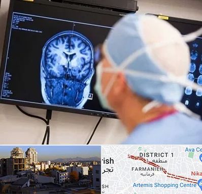 دکتر مغز و اعصاب کودکان در فرمانیه 