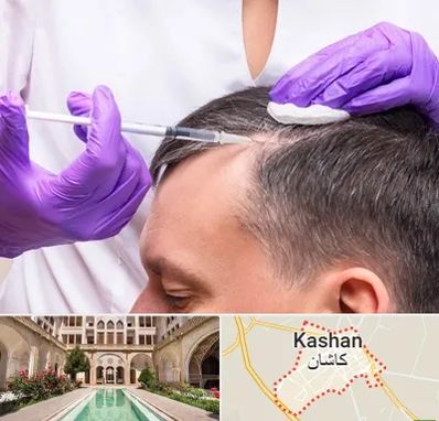 دکتر فوق تخصص پوست و مو در کاشان