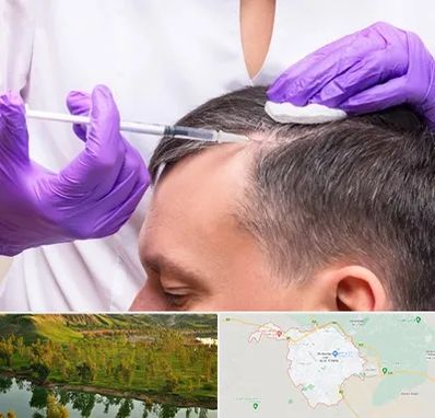 دکتر فوق تخصص پوست و مو در بهبهان