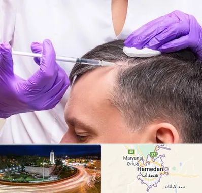 دکتر فوق تخصص پوست و مو در همدان