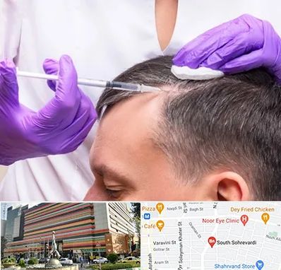 دکتر فوق تخصص پوست و مو در سهروردی 