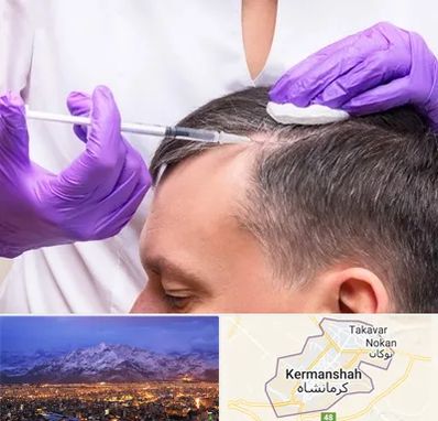 دکتر فوق تخصص پوست و مو در کرمانشاه