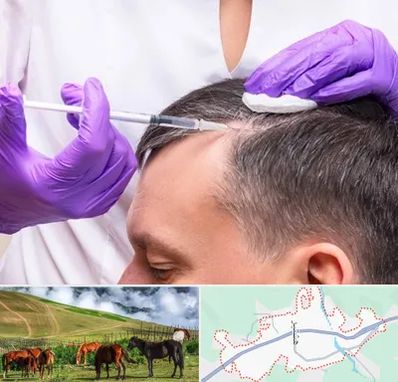 دکتر فوق تخصص پوست و مو در تالش