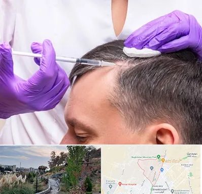 دکتر فوق تخصص پوست و مو در باغستان کرج 