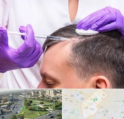 دکتر فوق تخصص پوست و مو در کمال شهر کرج 