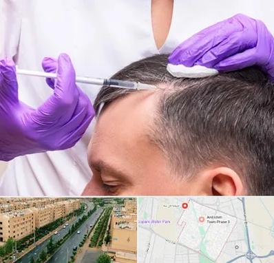 دکتر فوق تخصص پوست و مو در فاز سه اندیشه