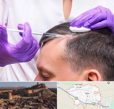 دکتر فوق تخصص پوست و مو در بم