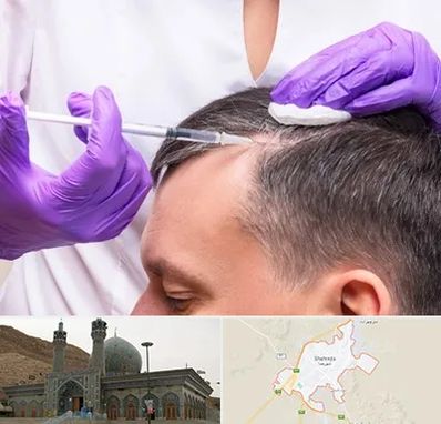 دکتر فوق تخصص پوست و مو در شهرضا