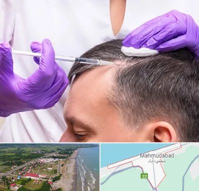 دکتر فوق تخصص پوست و مو در محمودآباد