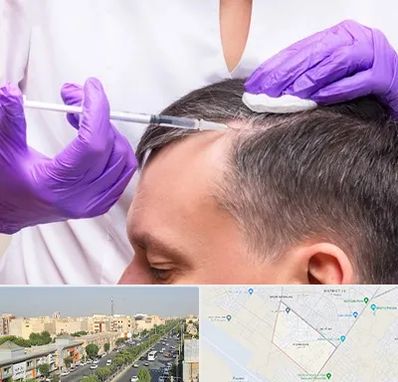 دکتر فوق تخصص پوست و مو در کیانمهر کرج 