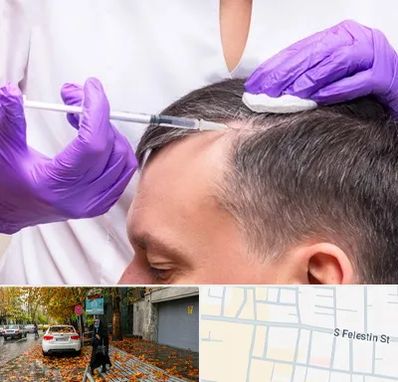 دکتر فوق تخصص پوست و مو در خیابان فلسطین